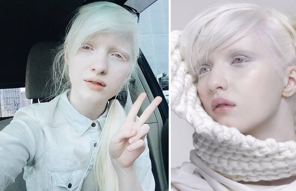 Eterična princeza: Model Nastya Zhidkova najpoznatija je albino djevojka u svijetu manekenstva
