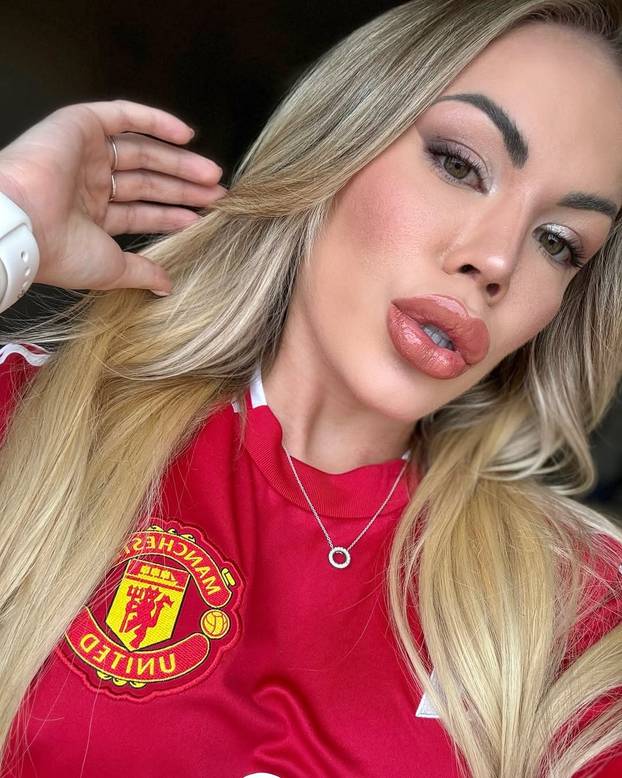 FOTO Brazilka upozorava: Ne snimajte na - 10 na snijegu! Ja sam dobila ozebline na guzi...'