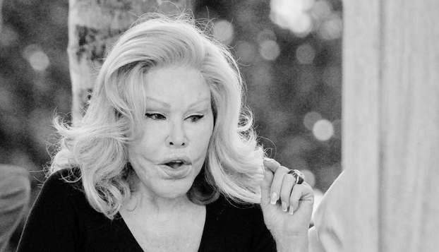 FOTO Zbog operacija postali neprepoznatljivi: Neke zvijezde su 'pod nož' išle čak 300 puta