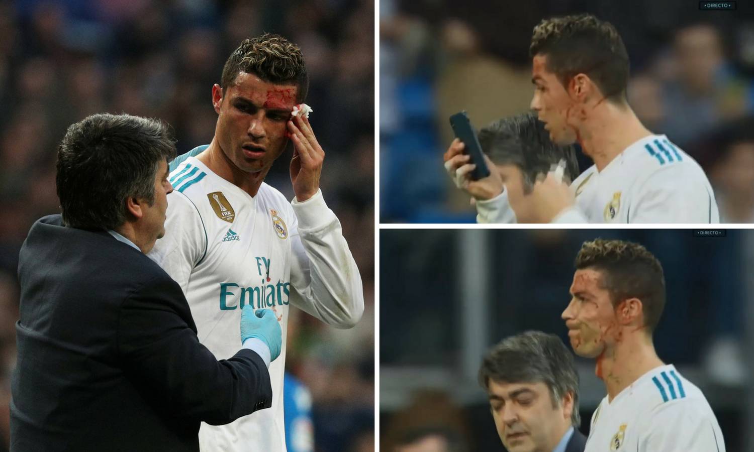 Ronaldo dobio nogom u glavu pa se krvav ogledao u mobitelu