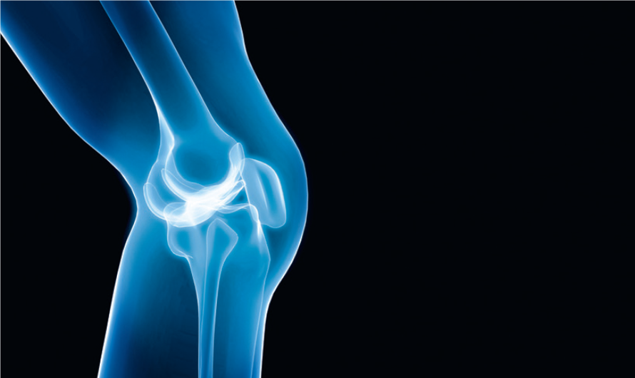 Kako liječiti svoje zglobove i kosti?