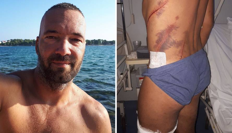 Propeler ga je izrezao do kosti: Sekunda je trajala kao vječnost