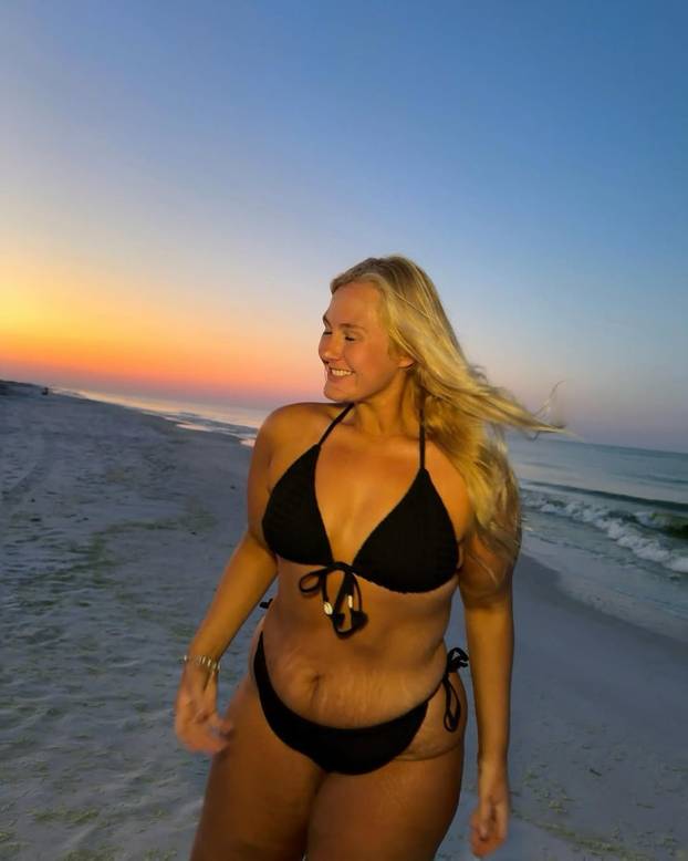 FOTO 'Dečki su me ostavljali zbog moje kilaže. Izgubila sam 80 kg i sad me žele natrag...'