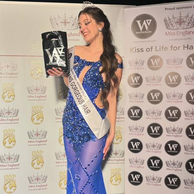 FOTO U Engleskoj pobijedio prvi AI klon misice! Jessica govori 150 jezika. Pljušte kritike...