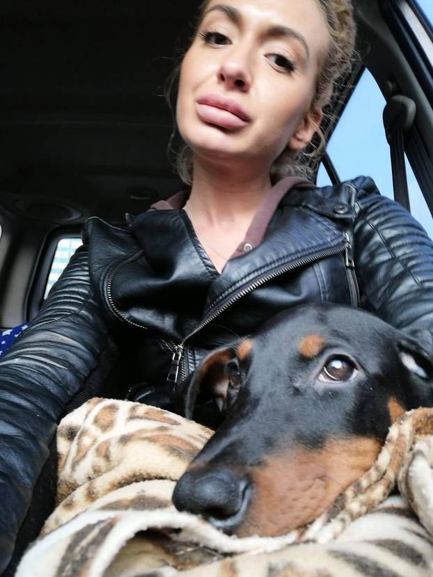 Žena s 'najvećim obrazima na svijetu' objavila fotografiju iz mladosti: 'Šok! Šteta ljepote'