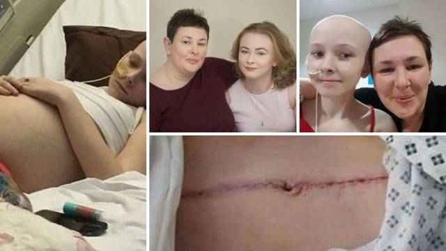 Djevojčici (13) govorili da ima zatvor, a u njoj je rastao tumor