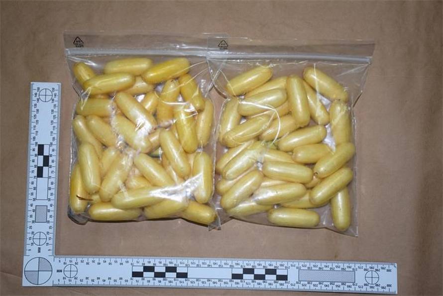 FOTO Ovo je uhićena brazilska mula koja je gutala kapsule s drogom. Neke su ranije 'ispale'