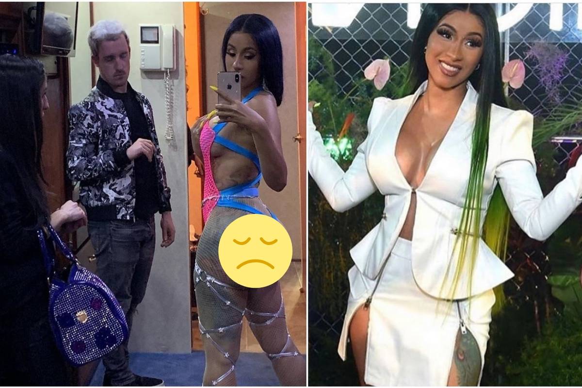 Liposukcija Cardi B nije prošla dobro: Ma, nikada više pod nož!