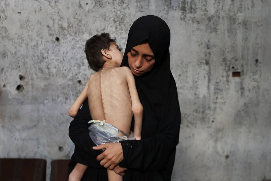 Displaced Palestinian mother Samah Matar holds her malnourished son Youssef, in Gaza City