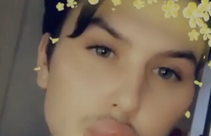 Potrošio 300 tisuća kuna jer želi izgledati kao Kylie Jenner!