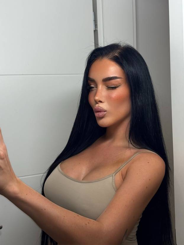 FOTO Soraya iz 'Gospodina Savršenog' pokazala nove grudi nakon estetske operacije