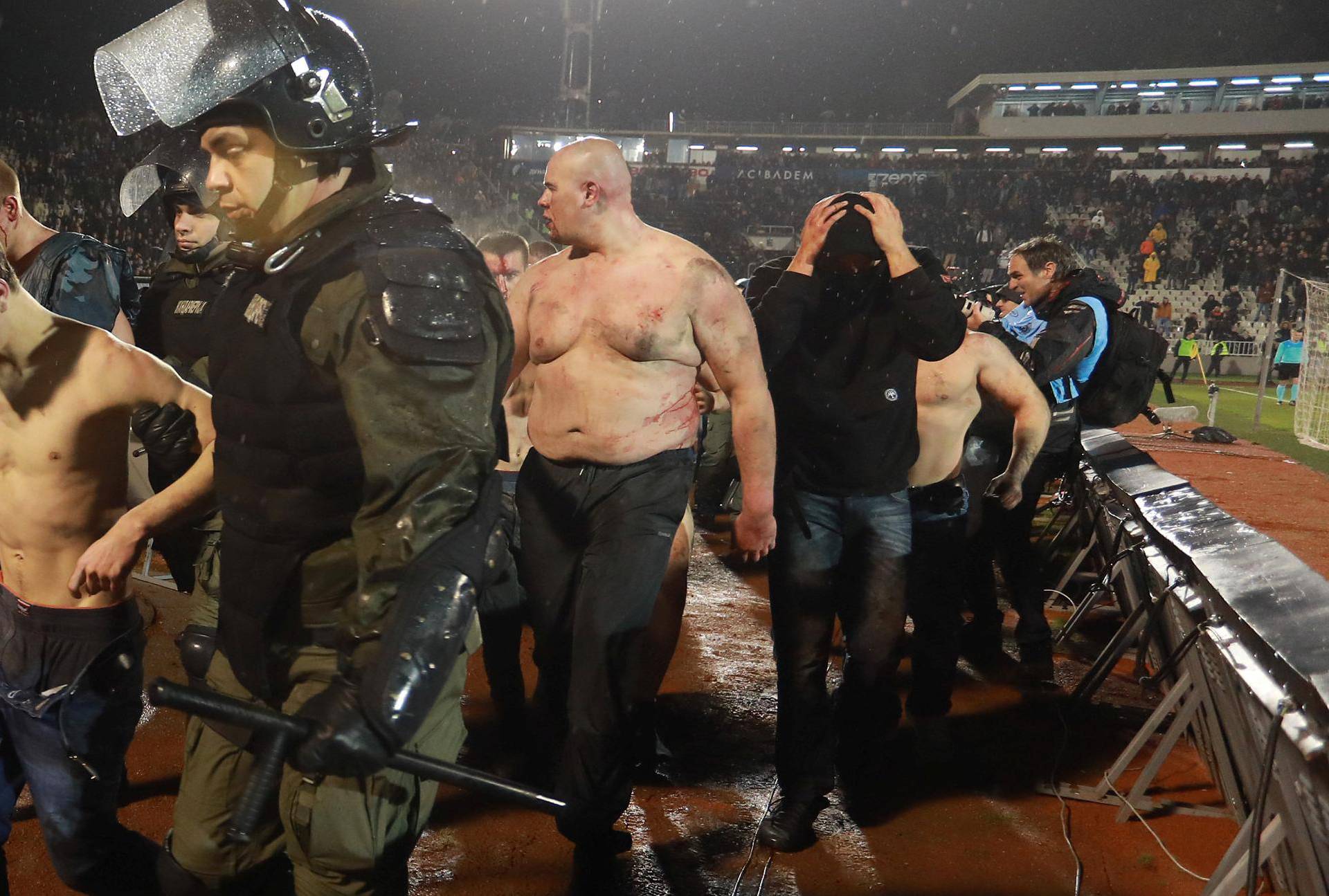 Police escort the soccer fans injured during the fights at a match between Red Star and Partizan in Belgrade