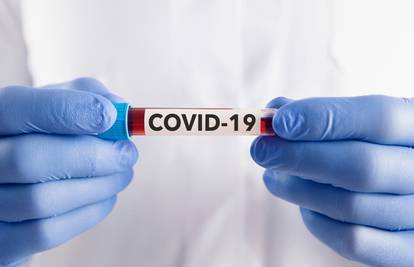 U Hrvatskoj 655 novozaraženih koronavirusom, umrlo šest ljudi
