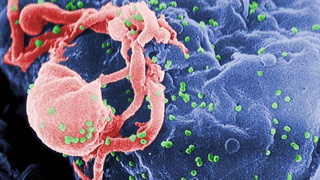 Alarmantan broj novorođenčadi otporan na lijekove protiv HIV-a