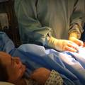 Prirodni carski rez: Doktori puste bebu da izmigolji sama