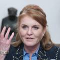 Sarah Ferguson ima rak dojke