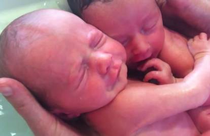 Nevjerojatni fenomen: Rodila blizance, svaki ima svog tatu