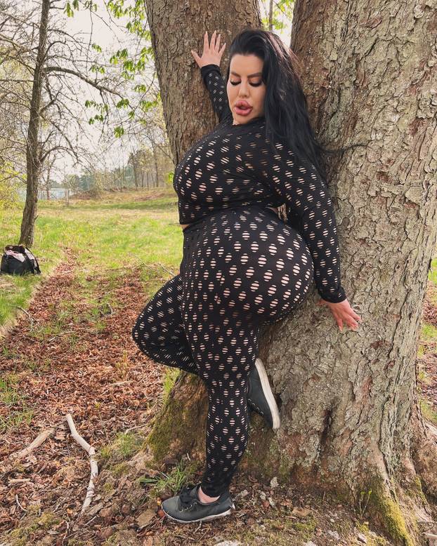 FOTO Stražnjica mi teži 45 kila, no već imam u planu sljedeću operaciju, želim imati najveću!