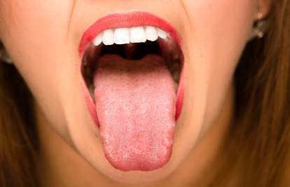 Pogledajte svoj jezik! Otkriva ozbiljne zdravstvene probleme