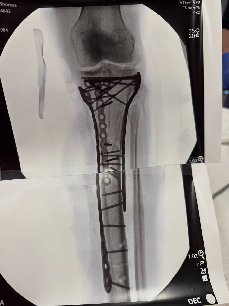 FOTO Lindsey Vonn vratila se kući, dočekao je bolan prizor: 'Bit će teško i bolno putovanje'
