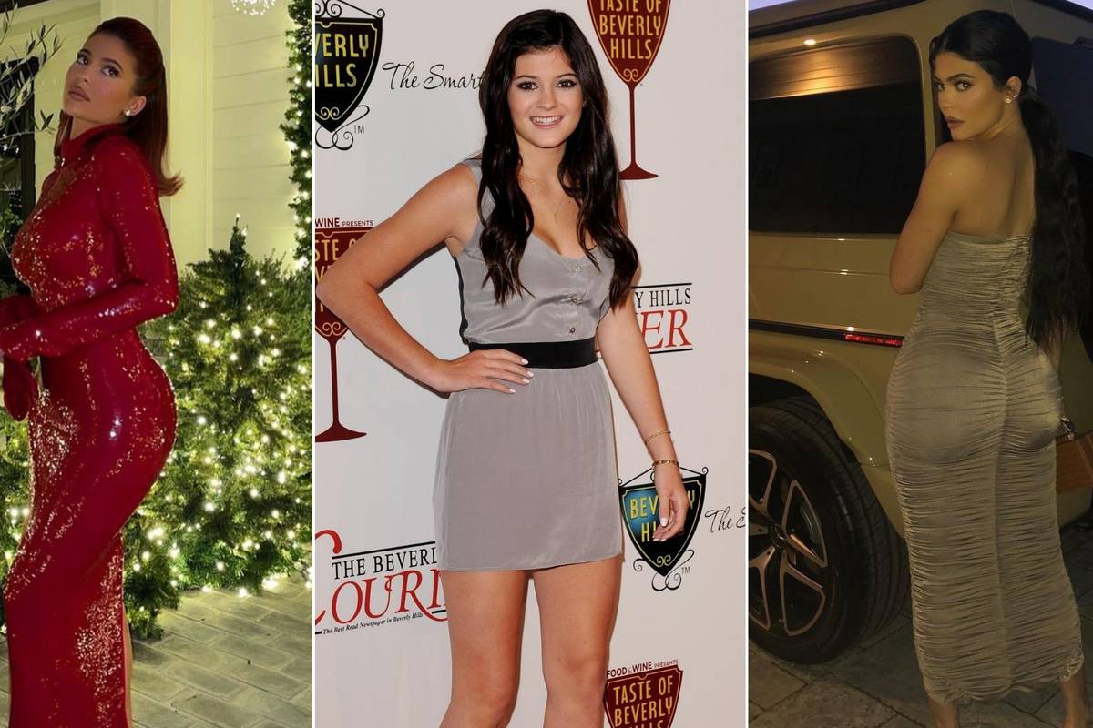 Koliko je i kakvih zahvata imala Kylie Jenner? Pogledajte fotke, usporedite i sami procijenite...