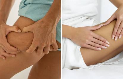 Namirnice zbog kojih se celulit još jače vidi - izbjegavajte ih!