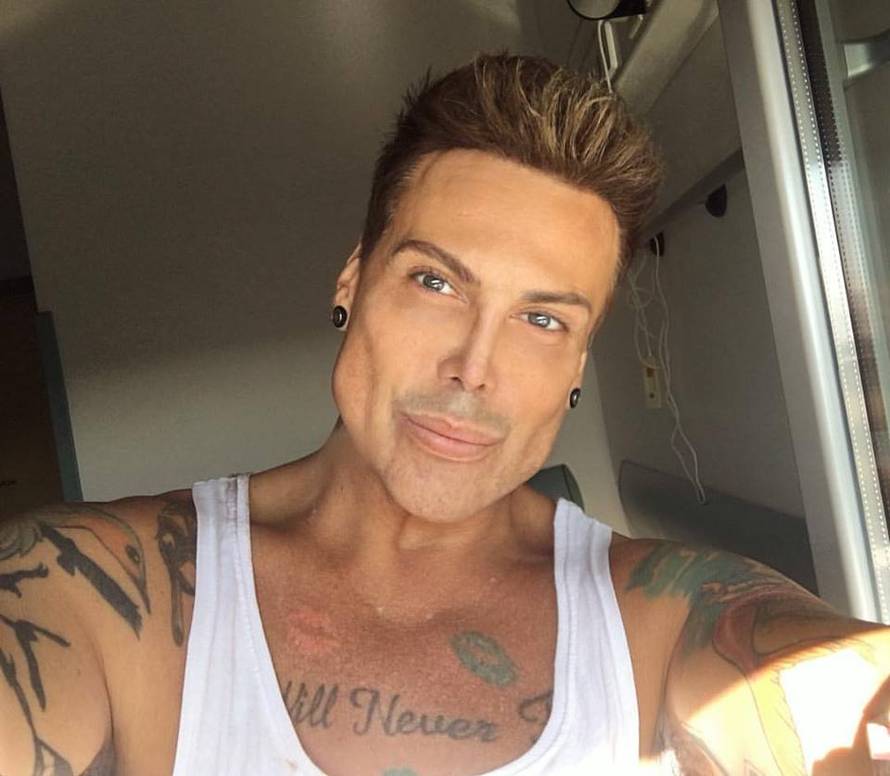 Neven Ciganović si je ravnao nos pa mu je stradao penis...