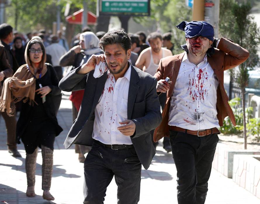 Injured Afghans run from the site of a blast in Kabul, Afghanistan