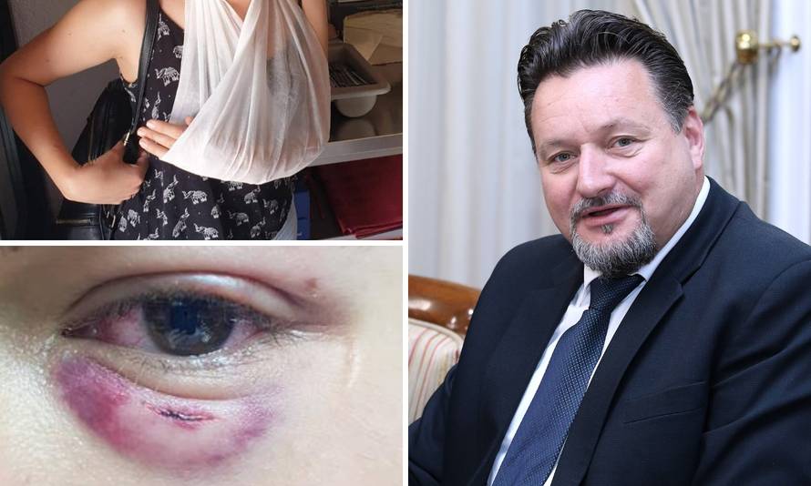 Mlatio sezonce, a Kuščević mu je pomogao lani: 'Istina, jesam'