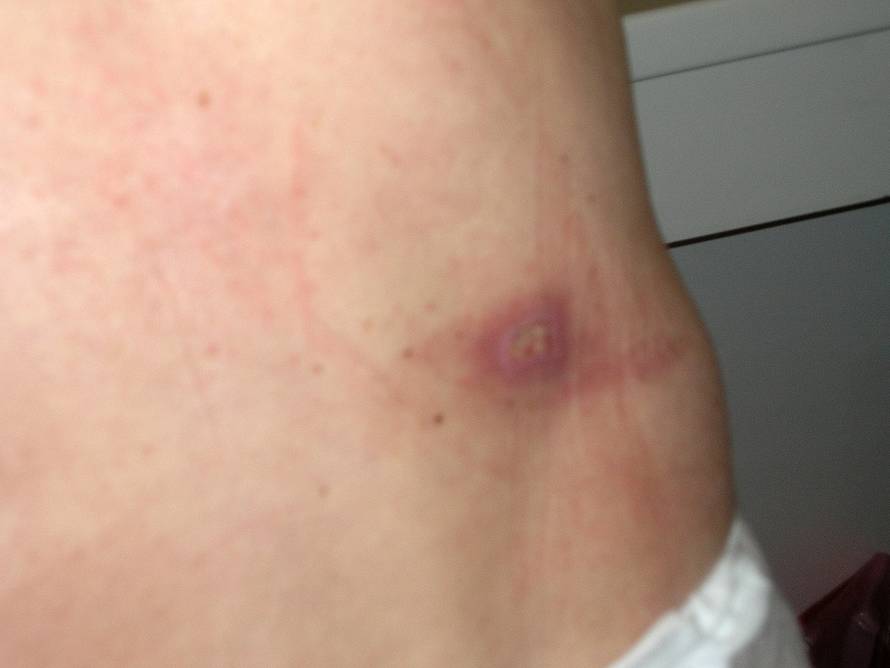 Željko Hladika/24sata