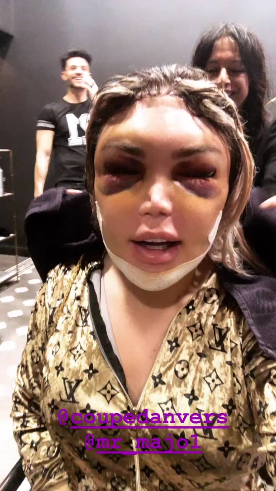 Ljudski Ken opet išao pod nož: Sad ne mogu govoriti ni gledati