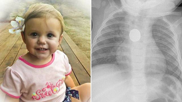 Odbili rendgen: Kći mi je mrtva jer mi doktori nisu vjerovali...