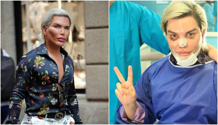 Ljudski Ken želi mačkaste oči: 'Dosta mi je dosadnog izgleda'