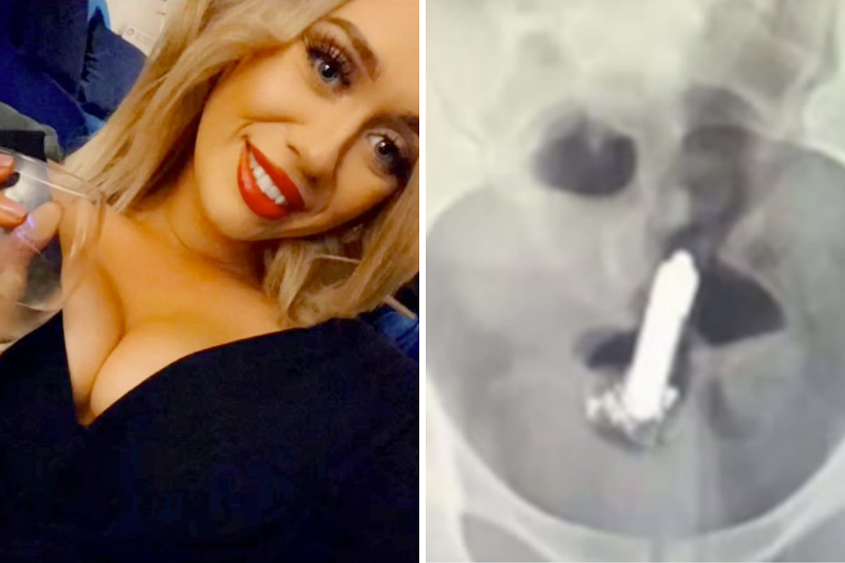 Mladoj mami iz Essexa vibrator zapeo u stražnjici: 'Jedva sam zaspala, vibrirao je cijelu noć'