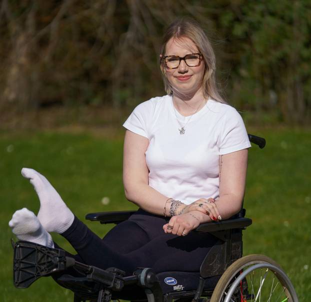 Woman's heart-breaking decision for double amputation after legs bend at 45 degrees