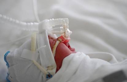 Svaka deseta rodilja ima težak oblik korone i nije se cijepila: 'Umiranje djece je 2 puta češće'