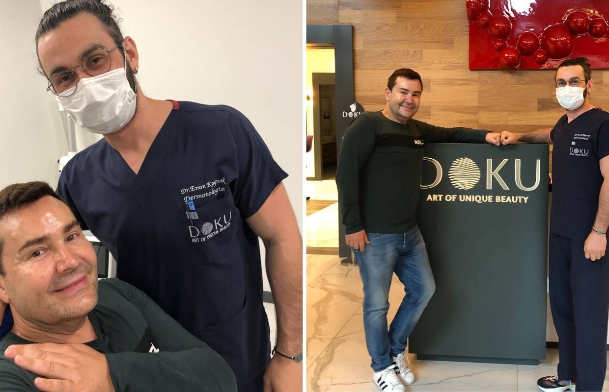 Boris Kosmač je kralj botoksa; Pegla bore već 20 godina, a na tretman je otišao i do Turske