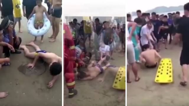 'Ležao na plaži u agoniji': Raža mu se bodljom zabila u penis!