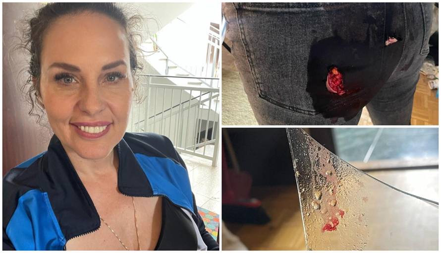 Anđa Marić je sjela u vitrinu i pokazala strašnu ozljedu: 'Ovo je bilo u meni, čekam hitnu...'