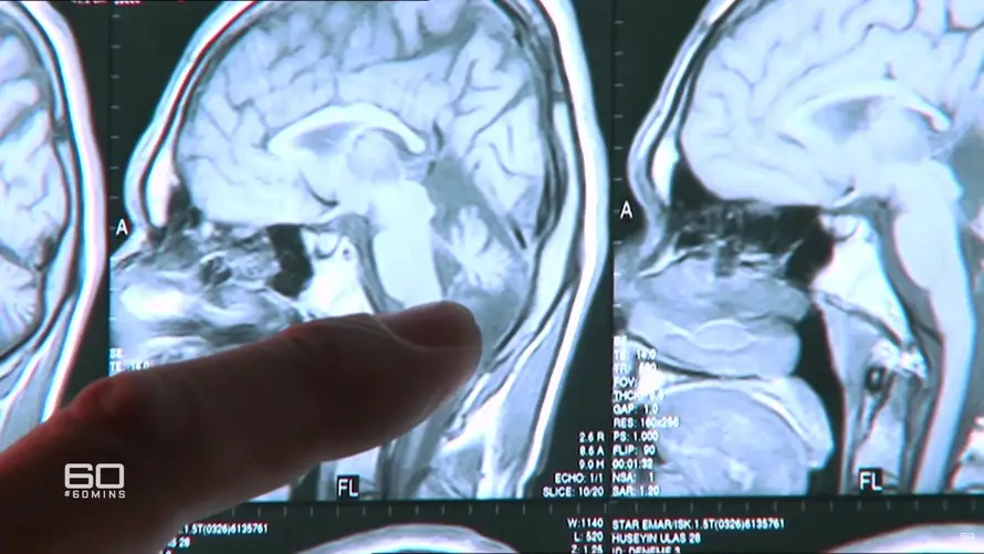 VIDEO Obitelj hoda na sve četiri, znanstvenici šokirani: 'Pa oni uopće ne bi trebali postojati!'