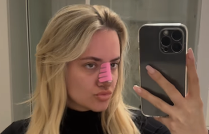 Meri Goldašić pokazala kako joj nos izgleda nakon operacije