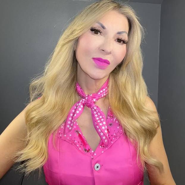 FOTO 'Bila sam muškobanjasta, ali uložila sam u izgled i sada sam savršena poput Barbie!'