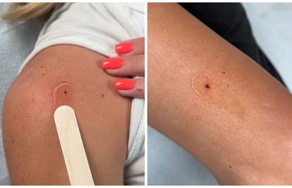 Mikro-tetovaža koja je zaludila internet: 'Jedina koju mi mama neće vidjeti'. Cijena joj je hit