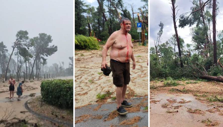 Sociolog Lalić ozlijeđen u oluji u Splitu: 'Spašavao sam psa, a sada imam šavove na glavi'