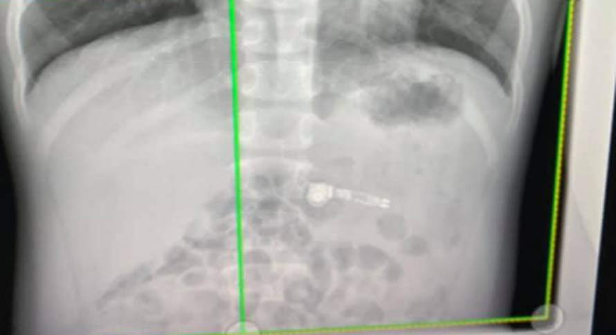 Roditelji, pripazite na djecu! Po novome, jedu AirPod slušalice