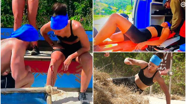 Mihaela iz 'Survivora' ozlijedila se na izazovu: Raskrvarila je koljeno, na nosilima je odnijeli