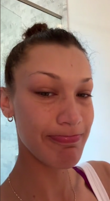 VIDEO Bella Hadid o izazovima nakon infekcije čeljusti: 'Molim vas, poslušajte svoje tijelo...'