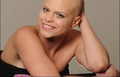 Jade Goody shrvana jer se rak širi na jetra i bubrege