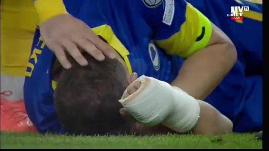 VIDEO Edinu Džeki slomili nos! Nakon utakmice se ipak našalio