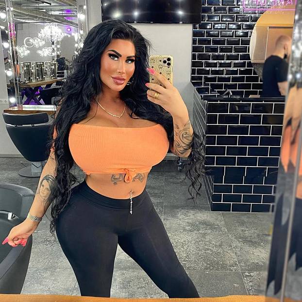 FOTO Barbie iz Berlina pobrala lovu bake pa ulupala 36.000 € u operacije: 'Ja sam umjetnost'